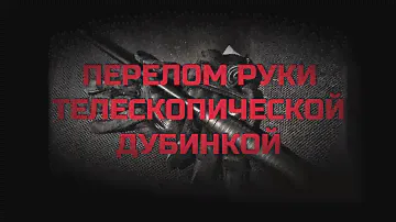 Перелом руки телескопической дубинкой. Проект Чистота.